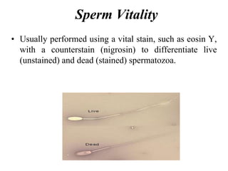 Sperm Vitality
• Usually performed using a vital stain, such as eosin Y,
with a counterstain (nigrosin) to differentiate live
(unstained) and dead (stained) spermatozoa.
 