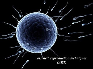 assisted reproduction techniques
(ART)
 