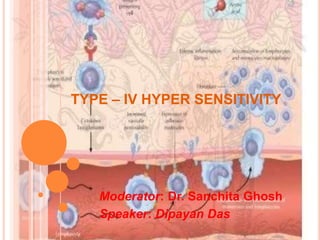 TYPE – IV HYPER SENSITIVITY
Moderator: Dr. Sanchita Ghosh
Speaker: Dipayan Das
 