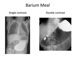 Bari Injection uses and indication of radiology in surgery | PPTX