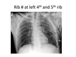 uses and indication of radiology in surgery | PPTX