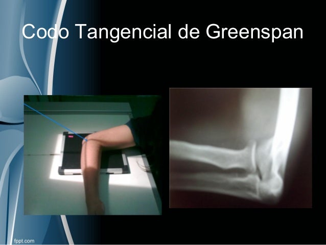 PROYECCIÓNES RADIOLÓGICAS EN TRAUMATOLOGÍA