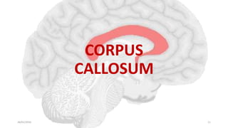CORPUS
CALLOSUM
26/01/2016 11
 