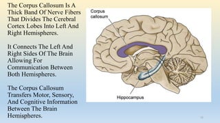 The Corpus Callosum Is A
Thick Band Of Nerve Fibers
That Divides The Cerebral
Cortex Lobes Into Left And
Right Hemispheres.
It Connects The Left And
Right Sides Of The Brain
Allowing For
Communication Between
Both Hemispheres.
The Corpus Callosum
Transfers Motor, Sensory,
And Cognitive Information
Between The Brain
Hemispheres.26/01/2016 12
 