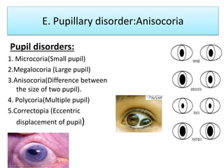 Common Neuro Ophthalmological Disorder | PPTX