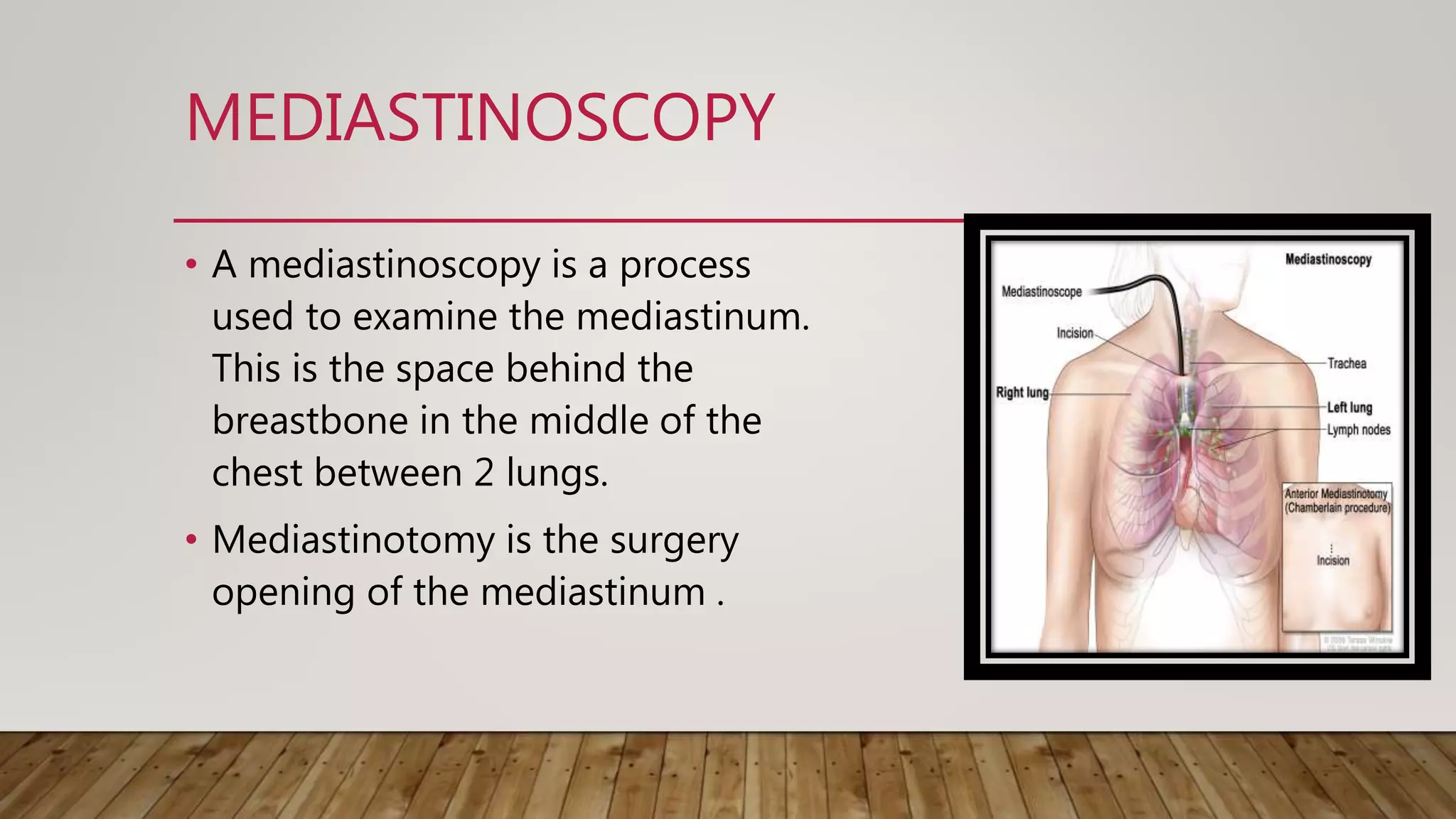 Thoracic surgery and it's management | PPTX