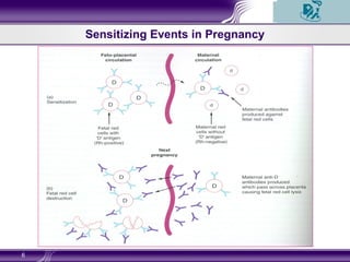 6
Sensitizing Events in Pregnancy
 