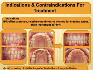 interproximal reduction of enamel as part of orthodontics | PPTX
