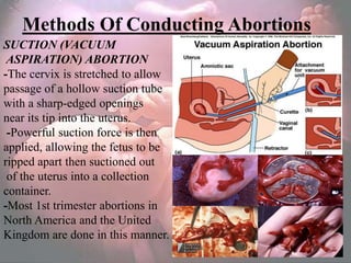 Methods Of Conducting Abortions
SUCTION (VACUUM
 ASPIRATION) ABORTION
-The cervix is stretched to allow
passage of a hollow suction tube
with a sharp-edged openings
near its tip into the uterus.
 -Powerful suction force is then
applied, allowing the fetus to be
ripped apart then suctioned out
 of the uterus into a collection
container.
-Most 1st trimester abortions in
North America and the United
Kingdom are done in this manner.
 