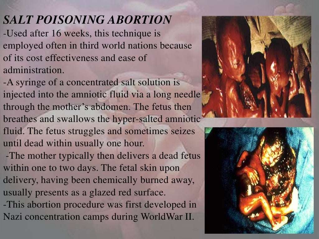 Abortion Ppt