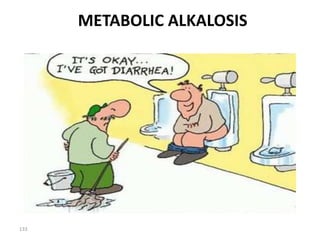 133
METABOLIC ALKALOSIS
 
