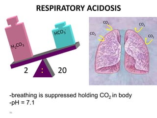 96
RESPIRATORY ACIDOSIS
-breathing is suppressed holding CO2 in body
-pH = 7.1
2 20
:
CO2
CO2
CO2
CO2
 