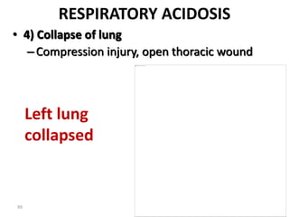 99
RESPIRATORY ACIDOSIS
• 4) Collapse of lung
–Compression injury, open thoracic wound
Left lung
collapsed
 