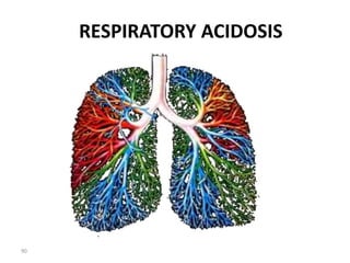 90
RESPIRATORY ACIDOSIS
 
