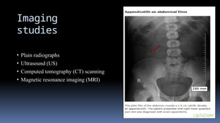 Imaging
studies
• Plain radiographs
• Ultrasound (US)
• Computed tomography (CT) scanning
• Magnetic resonance imaging (MRI)
 