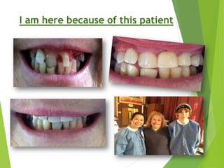 Aesthetic Anterior Composite - A Simple Technique | PDF