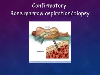 Confirmatory
Bone marrow aspiration/biopsy
 