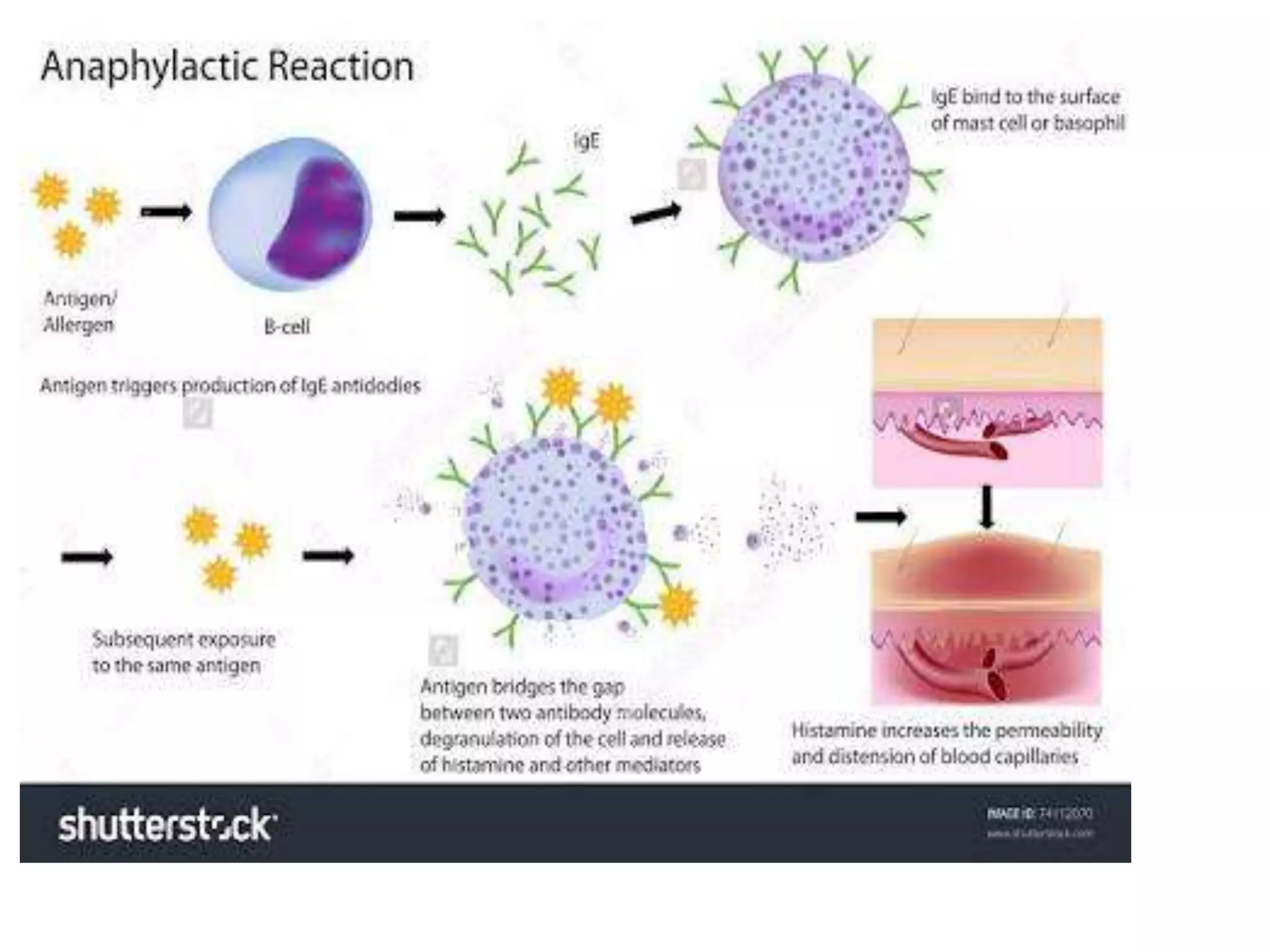 Final anaphylactic reactions and anaphylactic shock | PPTX
