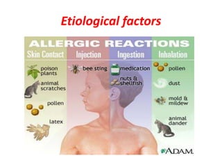 Etiological factors
 