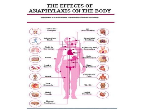 Final anaphylactic reactions and anaphylactic shock | PPTX
