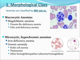 1. Morphological Class
Anemias are classified by RBC size as
Macrocytic Anemias
Megaloblastic anemias
 Vitamin B12 deficiency anemia
 Folic acid deficiency anemia
Microcytic, hypochromic anemias
Iron deficiency anemia
Genetic anomaly
 Sickle cell anemia
 Thalassemia
 Other hemoglobinopathies (abnormal hemoglobins)
 