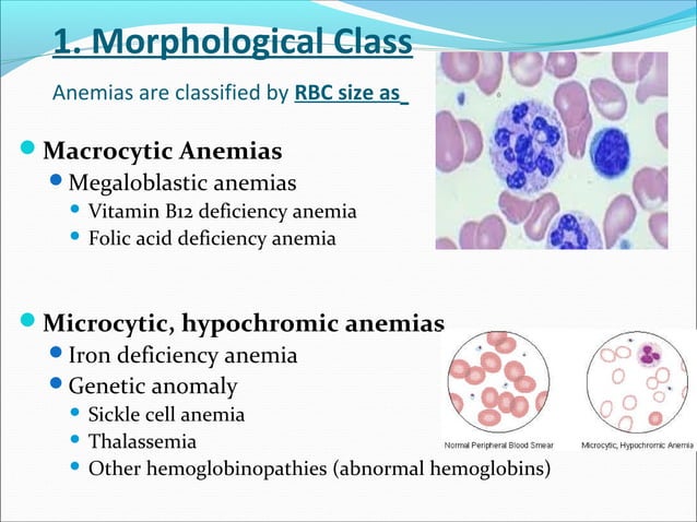 Final Anemia Ppt