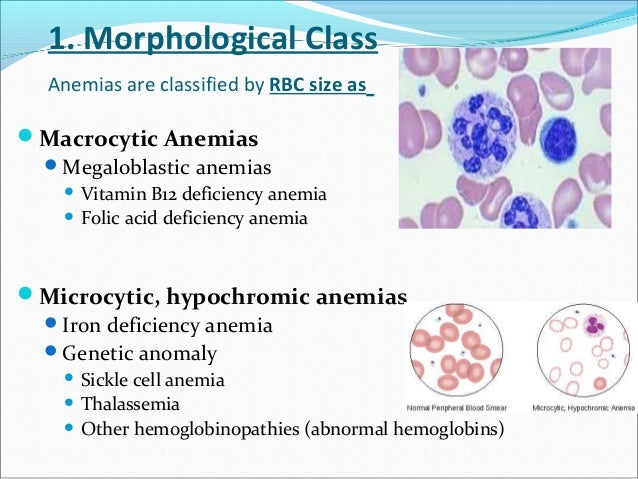 Anemia Rbc Morphology