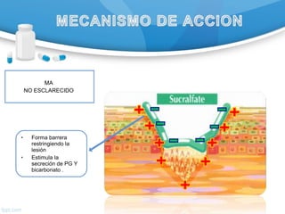 MA
NO ESCLARECIDO
• Forma barrera
restringiendo la
lesión
• Estimula la
secreción de PG Y
bicarbonato .
 