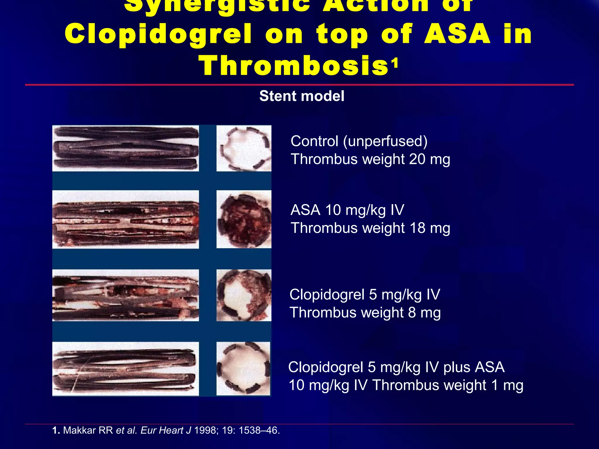 Synergistic Action of
Clopidogrel on top of ASA in
Thrombosis 1
Stent model
Control (unperfused)
Thrombus weight 20 mg
ASA 10 mg/kg IV
Thrombus weight 18 mg

Clopidogrel 5 mg/kg IV
Thrombus weight 8 mg

Clopidogrel 5 mg/kg IV plus ASA
10 mg/kg IV Thrombus weight 1 mg
1. Makkar RR et al. Eur Heart J 1998; 19: 1538–46.

 