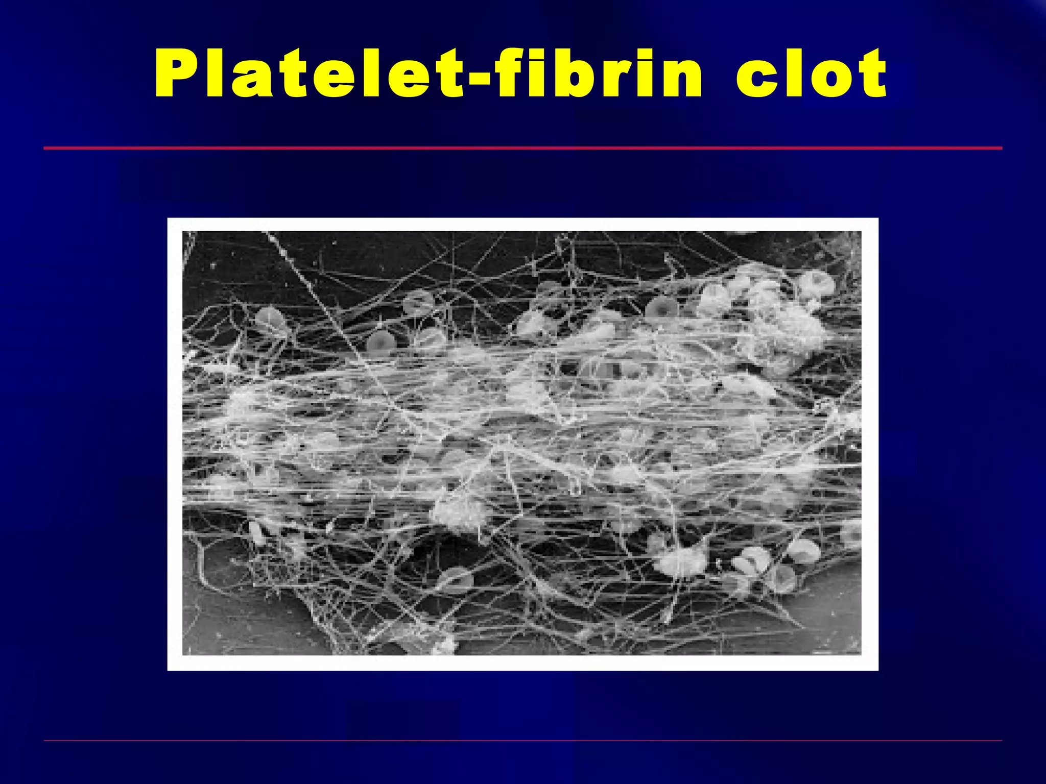 Platelet-fibrin clot

 