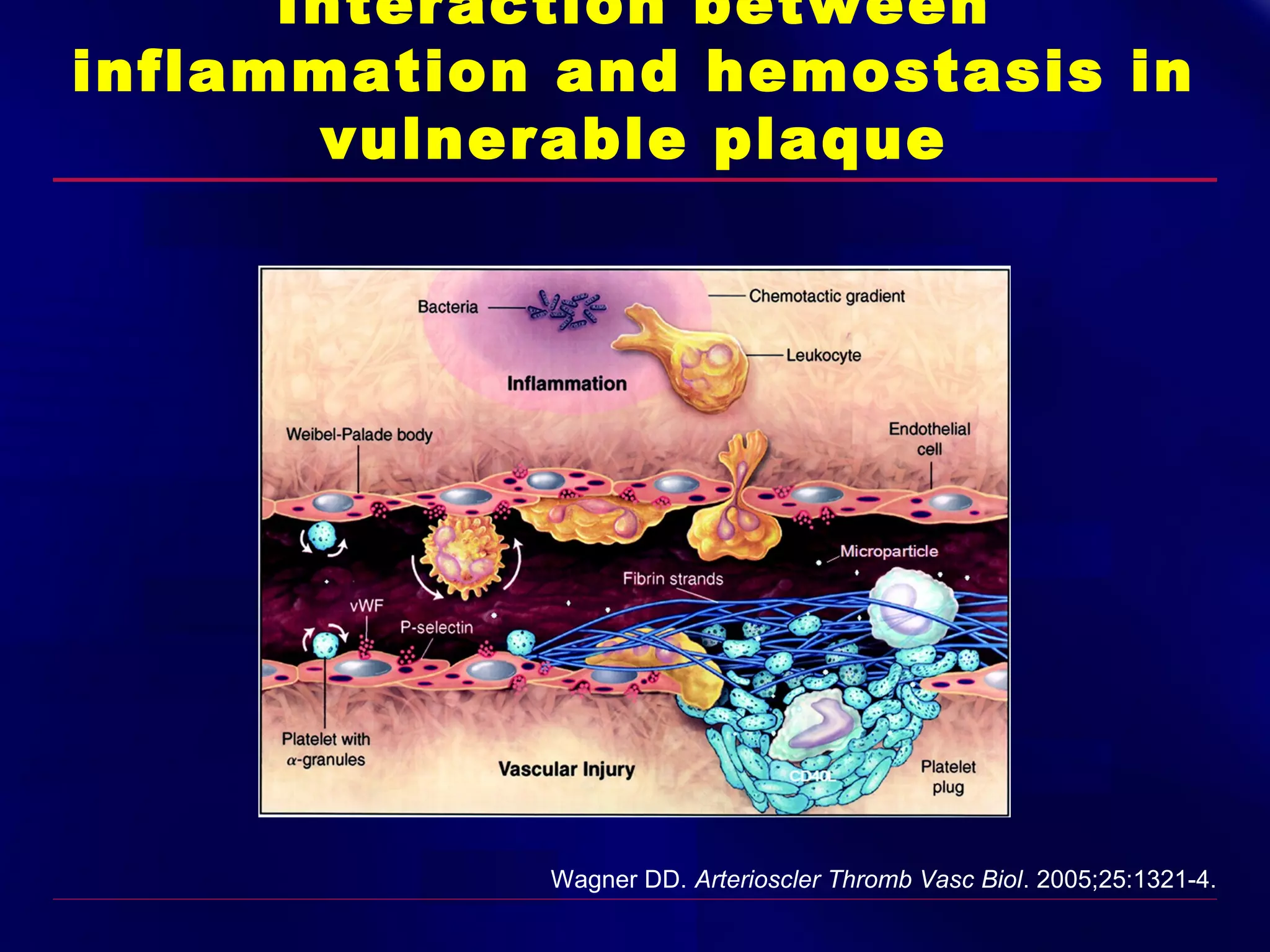 Interaction between
inflammation and hemostasis in
vulnerable plaque

Wagner DD. Arterioscler Thromb Vasc Biol. 2005;25:1321-4.

 