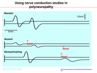 approach to polyneuropathy | PPTX