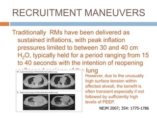 RECRUITMENT MANEUVERS
Traditionally RMs have been delivered as
sustained inflations, with peak inflation
pressures limited to between 30 and 40 cm
H2O, typically held for a period ranging from 15
to 40 seconds with the intention of reopening
collapsed regions of the lung
NEJM 2007; 354: 1775-1786
However, due to the unusually
high surface tension within
affected alveoli, the benefit is
often transient especially if not
followed by sufficiently high
levels of PEEP.
 