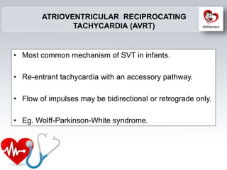 Pediatric Arrythmias | PPT