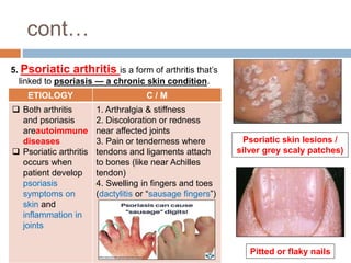cont…
5. Psoriatic arthritis is a form of arthritis that’s
linked to psoriasis — a chronic skin condition.
Psoriatic skin lesions /
silver grey scaly patches)
ETIOLOGY C / M
 Both arthritis
and psoriasis
areautoimmune
diseases
 Psoriatic arthritis
occurs when
patient develop
psoriasis
symptoms on
skin and
inflammation in
joints
1. Arthralgia & stiffness
2. Discoloration or redness
near affected joints
3. Pain or tenderness where
tendons and ligaments attach
to bones (like near Achilles
tendon)
4. Swelling in fingers and toes
(dactylitis or “sausage fingers”)
Pitted or flaky nails
 