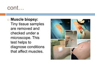 cont…
 Muscle biopsy:
Tiny tissue samples
are removed and
checked under a
microscope. This
test helps to
diagnose conditions
that affect muscles.
 