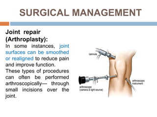 SURGICAL MANAGEMENT
Joint repair
(Arthroplasty):
In some instances, joint
surfaces can be smoothed
or realigned to reduce pain
and improve function.
These types of procedures
can often be performed
arthroscopically— through
small incisions over the
joint.
 