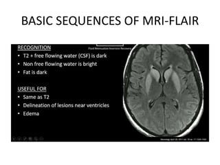 Final basic principles of mri icl | PPTX