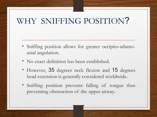 WHY SNIFFING POSITION?
• Sniffing position allows for greater occipito-atlanto-
axial angulation.
• No exact definition has been established.
• However, 35 degrees neck flexion and 15 degrees
head extension is generally considered worldwide.
• Sniffing position prevents falling of tongue thus
preventing obstruction of the upper airway.
 