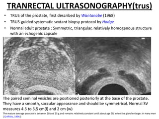 TRANRECTAL ULTRASONOGRAPHY(trus)
• TRUS of the prostate, first described by Wantanabe (1968)
• TRUS-guided systematic sextant biopsy protocol by Hodge
• Normal adult prostate : Symmetric, triangular, relatively homogenous structure
with an echogenic capsule
The mature average prostate is between 20 and 25 g and remains relatively constant until about age 50, when the gland enlarges in many men
( Griffiths, 1996 )
The paired seminal vesicles are positioned posteriorly at the base of the prostate.
They have a smooth, saccular appearance and should be symmetrical. Normal SV
measures 4.5 to 5.5 cm(l) and 2 cm (w)
 