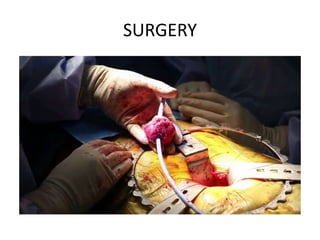 SURGERY
 