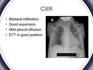 CXR
• Bilateral infiltration.
• Good expansion.
• Mild pleural effusion.
• ETT in good position.
 