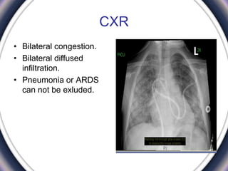 CXR
• Bilateral congestion.
• Bilateral diffused
infiltration.
• Pneumonia or ARDS
can not be exluded.
 