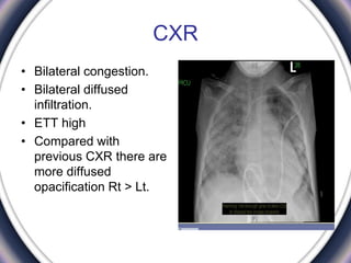 CXR
• Bilateral congestion.
• Bilateral diffused
infiltration.
• ETT high
• Compared with
previous CXR there are
more diffused
opacification Rt ˃ Lt.
 