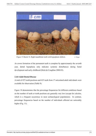 04E0750      Kildare County Council Sewerage Scheme, Castledermot town, Co. Kildare     ISSUE 7: Eachtra Journal - ISSN 2009-2237




                Figure 9. Burial 14. Right mandibular teeth with hypoplastic defects.               L. Fibiger




             As crown formation of the permanent teeth is complete by approximately the seventh
             year, dental hypoplasia only indicates systemic disturbances during foetal
             development and early childhood (Holst & Coughlan 2000:83).


             2.4.8 Adult Dental Disease
             A total of 473 tooth positions and 415 teeth from 17 articulated adult individuals were
             available for observation (Table 9).


             Figure 10 demonstrates that the percentage frequencies for different conditions based
             on the number of teeth or tooth positions are generally very low (except for calculus,
             which is a frequent occurrence in most archaeological populations). In contrast,
             percentage frequencies based on the number of individuals affected are noticeably
             higher (Fig. 11).




Permalink: http://eachtra.ie/index.php/journal/04e0750-castledermot-town-co-kildare/                                         236
 