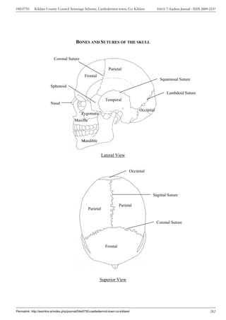 04E0750      Kildare County Council Sewerage Scheme, Castledermot town, Co. Kildare                  ISSUE 7: Eachtra Journal - ISSN 2009-2237




                                            BONES AND SUTURES OF THE SKULL


                            Coronal Suture

                                                                    Parietal
                                                  Frontal
                                                                                                      Squamosal Suture
                         Sphenoid
                                                                                                           Lambdoid Suture
                                                                  Temporal
                         Nasal
                                                                                         Occipital
                                                Zygomatic
                                           Maxilla



                                                Mandible


                                                                Lateral View


                                                                                   Occipital




                                                                                                 Sagittal Suture

                                                                            Parietal
                                                     Parietal


                                                                                                     Coronal Suture




                                                                  Frontal




                                                             Superior View




Permalink: http://eachtra.ie/index.php/journal/04e0750-castledermot-town-co-kildare/                                                      282
 