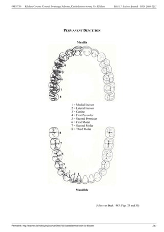 04E0750      Kildare County Council Sewerage Scheme, Castledermot town, Co. Kildare                       ISSUE 7: Eachtra Journal - ISSN 2009-2237




                                                         PERMANENT DENTITION


                                                                             Maxilla



                                                                         2      1
                                                                 3

                                                         4

                                                     5

                                                     6


                                                 7

                                                 8

                                                                         1 = Medial Incisor
                                                                         2 = Lateral Incisor
                                                                         3 = Canine
                                                                         4 = First Premolar
                                                                         5 = Second Premolar
                                                                         6 = First Molar
                                                                         7 = Second Molar
                                                                         8 = Third Molar
                                                8


                                                 7


                                                     6


                                                         5
                                                             4
                                                                     3
                                                                          2 1




                                                                             Mandible




                                                                                           (After van Beek 1983: Figs. 29 and 30)




Permalink: http://eachtra.ie/index.php/journal/04e0750-castledermot-town-co-kildare/                                                           283
 