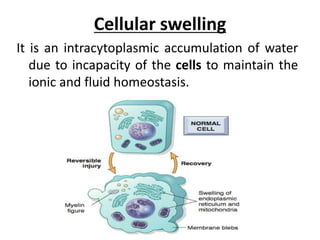 Cellular swelling
It is an intracytoplasmic accumulation of water
due to incapacity of the cells to maintain the
ionic and fluid homeostasis.
 