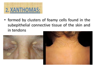 • formed by clusters of foamy cells found in the
subepithelial connective tissue of the skin and
in tendons
 