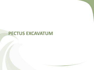 PECTUS EXCAVATUM
 